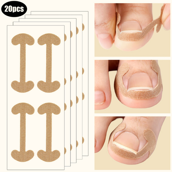 ToeFlex Nail Corrector Strips